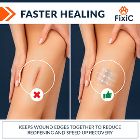 Wound Closure Kit