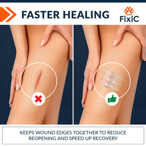 Wound Closure Kit