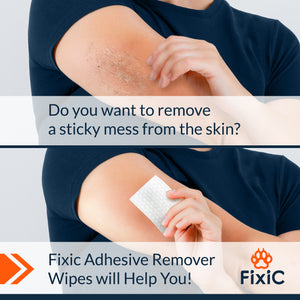 Adhesive Remover Wipes for Skin